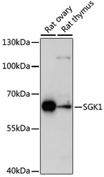 Anti-SGK1 antibody used in Western Blot (WB). GTX54726