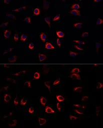 Anti-SGK1 antibody used in Immunocytochemistry/ Immunofluorescence (ICC/IF). GTX54726