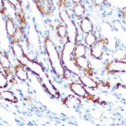 Anti-SGK1 antibody used in IHC (Paraffin sections) (IHC-P). GTX54726