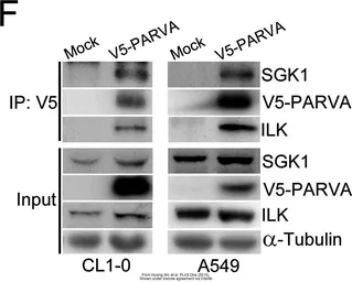 Anti-SGK1 antibody used in Western Blot (WB). GTX54726