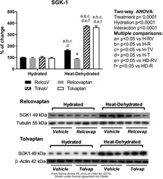 Anti-SGK1 antibody used in Western Blot (WB). GTX54726