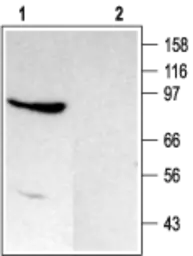 Anti-TRPC4 antibody used in Western Blot (WB). GTX54758