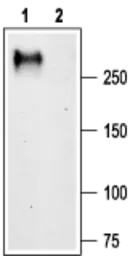 Anti-CACNA1G antibody used in Western Blot (WB). GTX54760