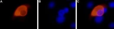 Anti-VR1/ TRPV1 antibody used in Immunocytochemistry/ Immunofluorescence (ICC/IF). GTX54762