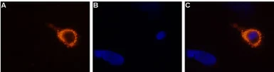 Anti-TRPV3 antibody used in Live cell imaging (LCI). GTX54763