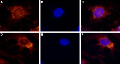 Anti-TRPV4 antibody used in Immunocytochemistry/ Immunofluorescence (ICC/IF). GTX54764