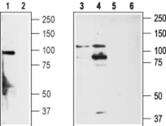 Anti-TRPA1 antibody used in Western Blot (WB). GTX54765