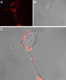 Anti-TRPA1 antibody used in Live cell imaging (LCI). GTX54765