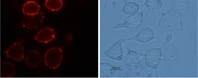 Anti-VRL1 antibody used in Live cell imaging (LCI). GTX54766