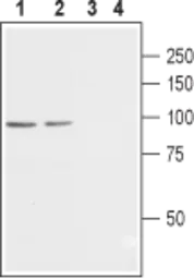 Anti-Cav beta 2 antibody used in Western Blot (WB). GTX54771