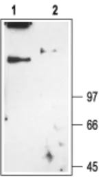 Anti-CLCN1 antibody used in Western Blot (WB). GTX54773