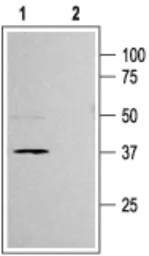 Anti-Kir6.2 antibody used in Western Blot (WB). GTX54777