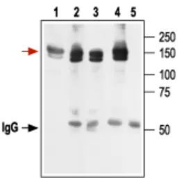 Anti-Kv11.1 antibody used in Immunoprecipitation (IP). GTX54785