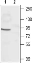 Anti-CNGA1 antibody used in Western Blot (WB). GTX54787