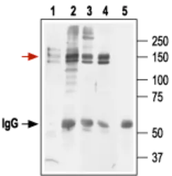 Anti-Kv11.1 antibody used in Immunoprecipitation (IP). GTX54789