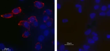 Anti-Kv11.1 antibody used in Live cell imaging (LCI). GTX54789