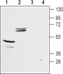 Anti-Kir5.1 antibody used in Western Blot (WB). GTX54791