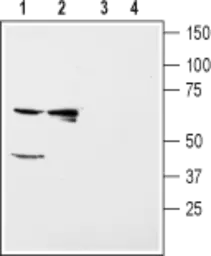 Anti-Kir5.1 antibody used in Western Blot (WB). GTX54791