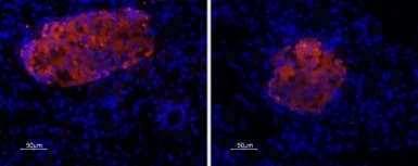 Anti-P2X7 antibody used in IHC (Paraffin sections) (IHC-P). GTX54794