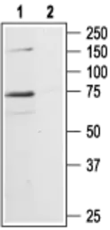 Anti-P2X7 antibody used in Western Blot (WB). GTX54794