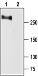 Anti-Nav1.2 antibody used in Western Blot (WB). GTX54797