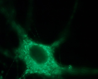 Anti-Nav1.7 antibody used in Immunocytochemistry/ Immunofluorescence (ICC/IF). GTX54800