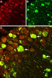 Anti-Nav1.7 antibody used in IHC (Frozen sections) (IHC-Fr). GTX54800