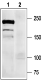 Anti-Nav1.7 antibody used in Western Blot (WB). GTX54800