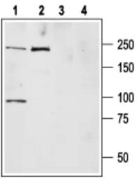 Anti-Nav1.7 antibody used in Western Blot (WB). GTX54800