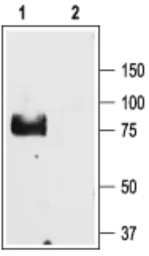 Anti-ENaC Gamma antibody used in Western Blot (WB). GTX54801