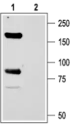 Anti-ASIC1 antibody used in Western Blot (WB). GTX54804