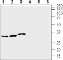 Anti-KCNE1 antibody used in Western Blot (WB). GTX54811