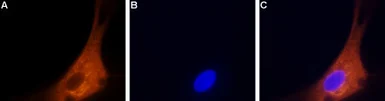 Anti-Cav2.2 antibody used in Immunocytochemistry/ Immunofluorescence (ICC/IF). GTX54812