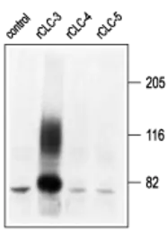 Anti-CLCN3 antibody used in Western Blot (WB). GTX54815