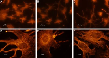 Anti-CNGA2 antibody used in Immunocytochemistry/ Immunofluorescence (ICC/IF). GTX54816