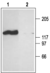 Anti-CNGA2 antibody used in Western Blot (WB). GTX54816