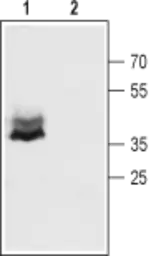 Anti-Connexin 43 antibody used in IHC (Free Floating) (IHC (Free Floating)). GTX54818