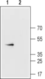 Anti-Connexin 43 antibody used in Western Blot (WB). GTX54818