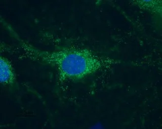 Anti-HCN1 antibody used in Immunocytochemistry/ Immunofluorescence (ICC/IF). GTX54823