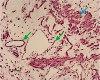 Anti-Kir6.1 antibody used in IHC (Paraffin sections) (IHC-P). GTX54833