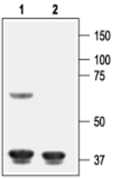 Anti-Kir6.1 antibody used in Western Blot (WB). GTX54833