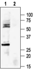 Anti-Kir6.1 antibody used in Western Blot (WB). GTX54833