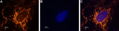 Anti-Nav1.1 antibody used in Immunocytochemistry/ Immunofluorescence (ICC/IF). GTX54841