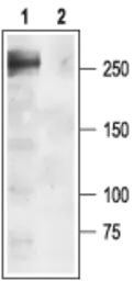 Anti-Nav1.1 antibody used in Western Blot (WB). GTX54841