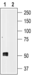 Anti-P2X1 antibody used in Western Blot (WB). GTX54849