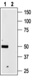 Anti-P2X4 antibody used in Western Blot (WB). GTX54851