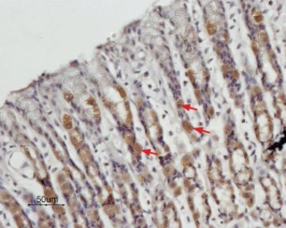 Anti-STIM1 antibody used in IHC (Paraffin sections) (IHC-P). GTX54855