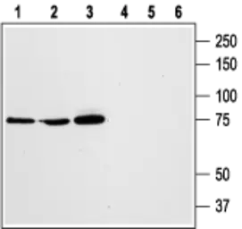 Anti-STIM1 antibody used in Western Blot (WB). GTX54855