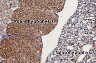 Anti-TRPC3 antibody used in IHC (Paraffin sections) (IHC-P). GTX54860