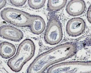 Anti-TRPM5 antibody used in IHC (Paraffin sections) (IHC-P). GTX54864